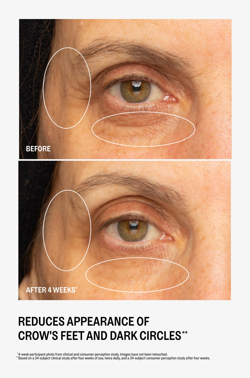 Ultra Renewal Eye Cream