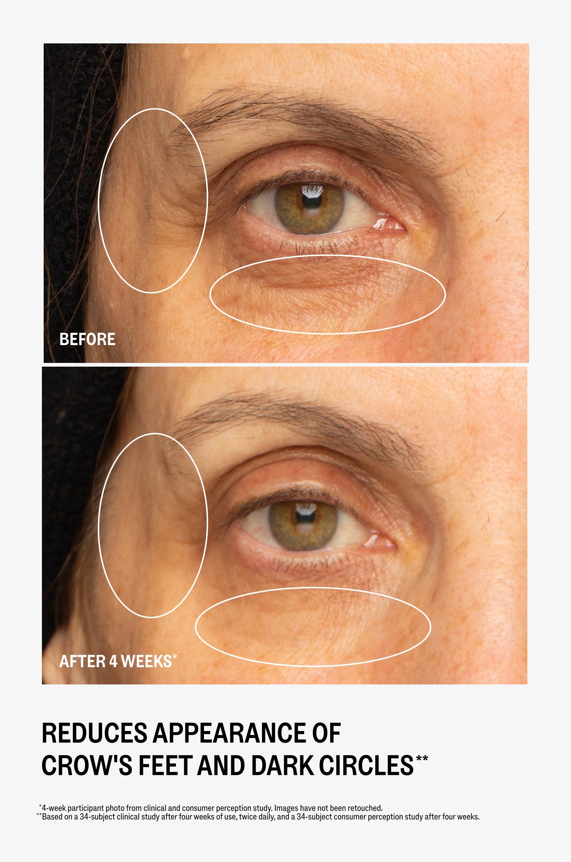 Ultra Renewal Eye Cream