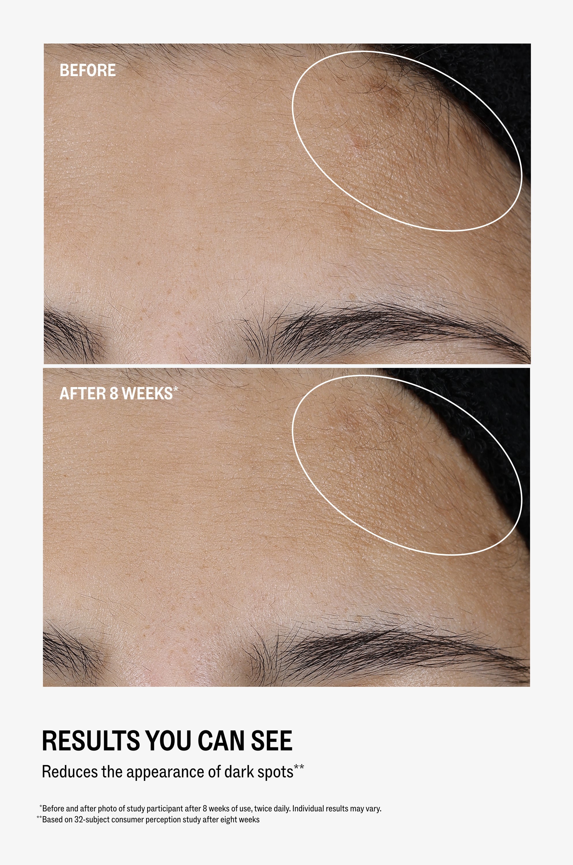 All Bright Vitamin C Serum